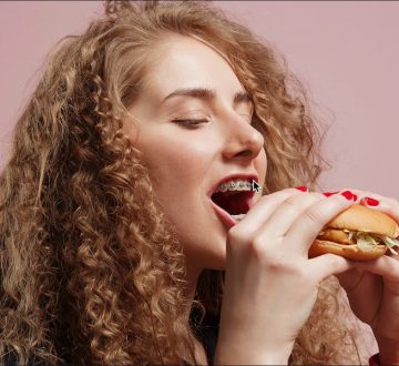 Fast Braces: An Effective Orthodontic Option for Straightening Teeth