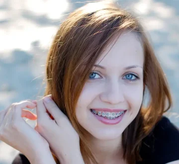 Here’s How FastBraces Can Restore Your Smile