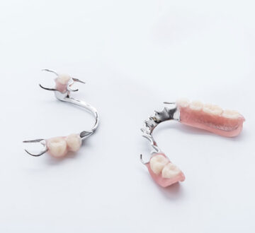 What is the Lifespan of Dentures and Overdentures?