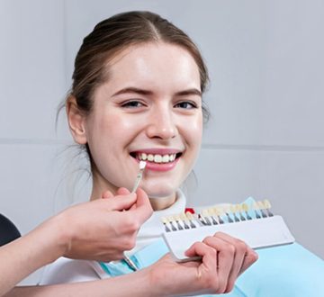 8 Key Benefits of Choosing Dental Veneers for a Smile Makeover