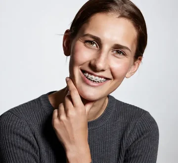 Fast Braces: The Best Orthodontic Option for Quick Results