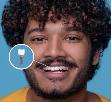 How Can I Restore My Smile with Implants or Fast Braces?